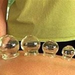 با “بادکش درمانی” آشنا شوید