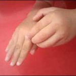 اگر خارش دارید بخوانید