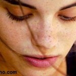 درمان و پیشگیری کک و مک