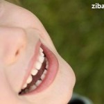 شکاف کام و لب