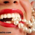 دانستنی های مهم درباره لامینیت دندان