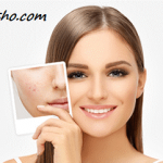 تفاوت آلرژی یا حساسیت پوستی