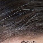 چرا موهایم سفید شد؟